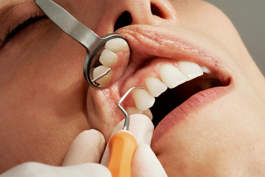 High-Precision CNC Machining for Dental and Medical Equipment